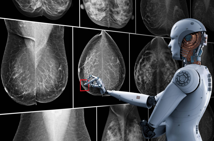  Avances científicos en la detección del cáncer de mama con inteligencia artificial