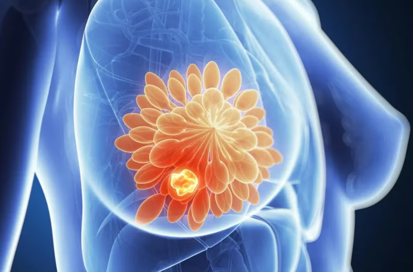  La Inteligencia Artificial revoluciona la detección temprana del cáncer de mama
